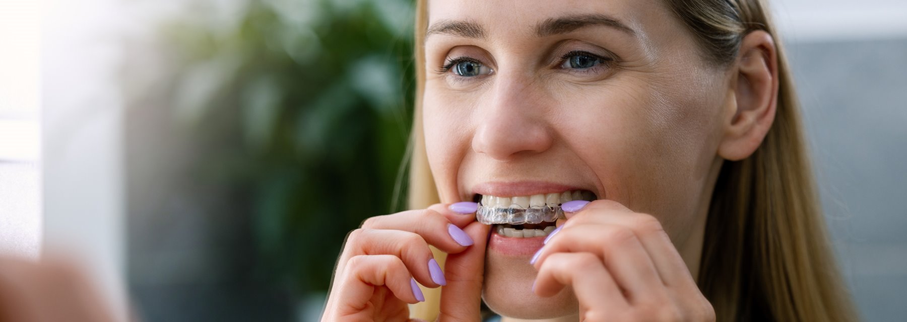 Post Orthodontic Care at East Lyme, Connecticut United States